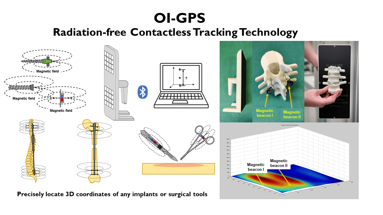 Non-contact, non-radiation device that accurately locates multiple body implants