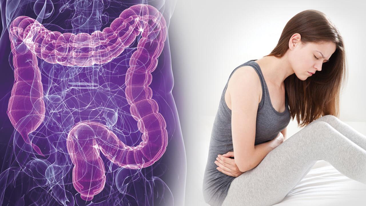 Chinese Medicine for Prevention and Treatment of Irritable Bowel Syndrome