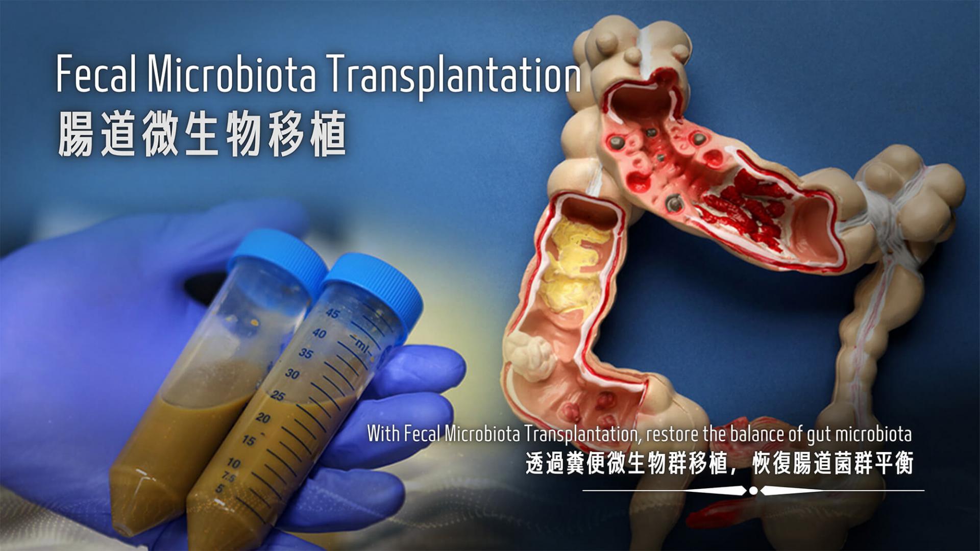 Artificial Intelligence-guided and Personalised Fecal Microbiota Transplantation (FMT) Treatment for Human Diseases