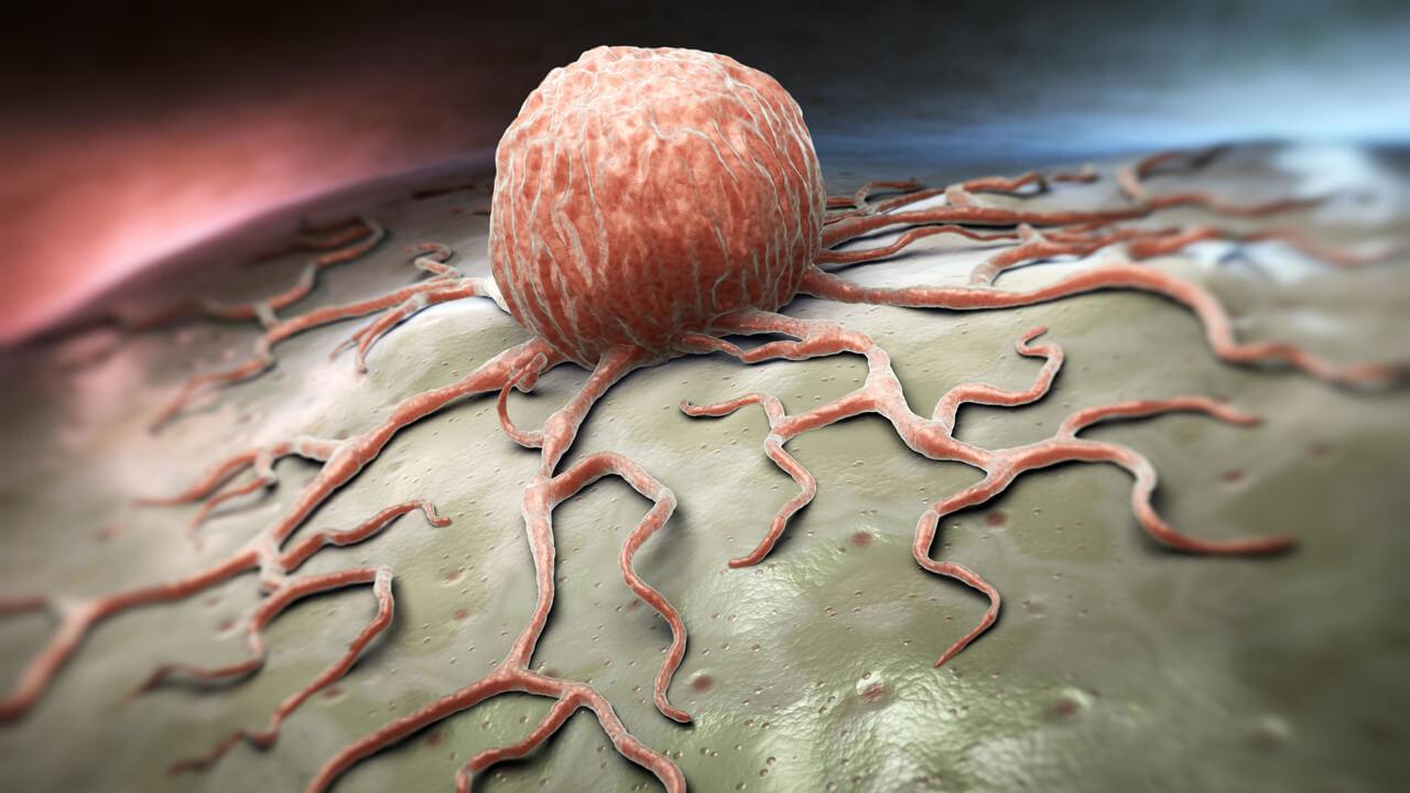 Cancer Catcher - Early Detection of Circulating Tumour Cells