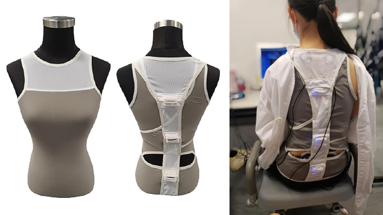 Biofeedback System with Body Mapping Clothing for Patients with Adolescent Idiopathic Scoliosis 1