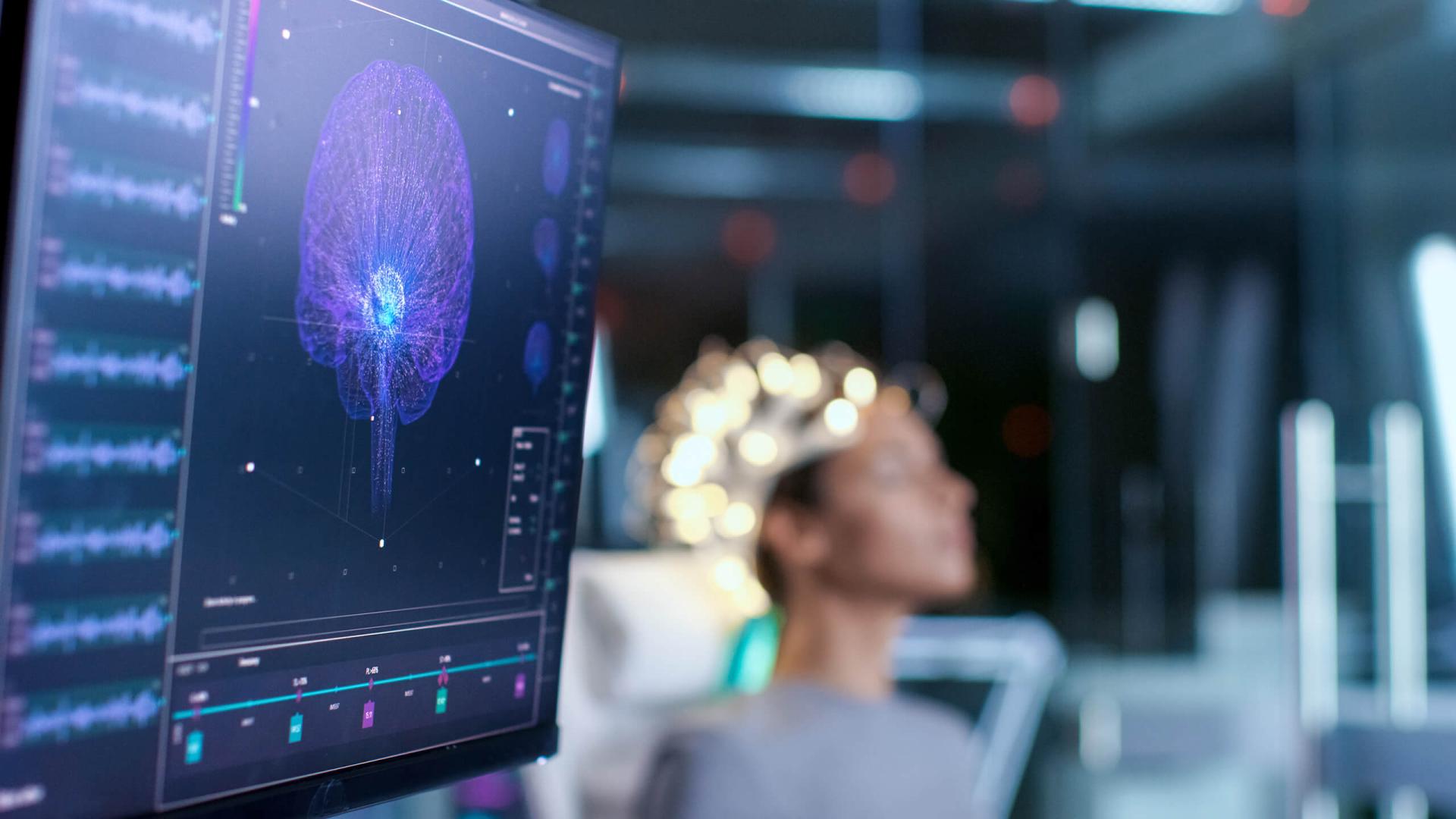 Co-Adaptive Brain-Machine Interface Prototype for Continuous Movement Control