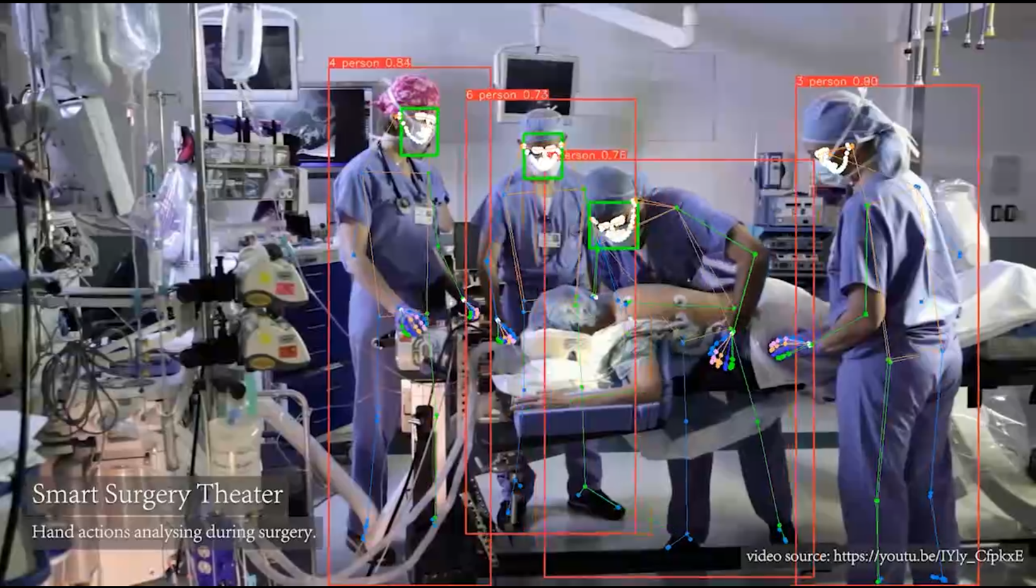 Safesugery AI system