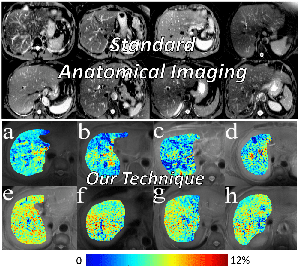 利用自旋鎖定磁振造影技術對人體組織進行非侵入性生化成像