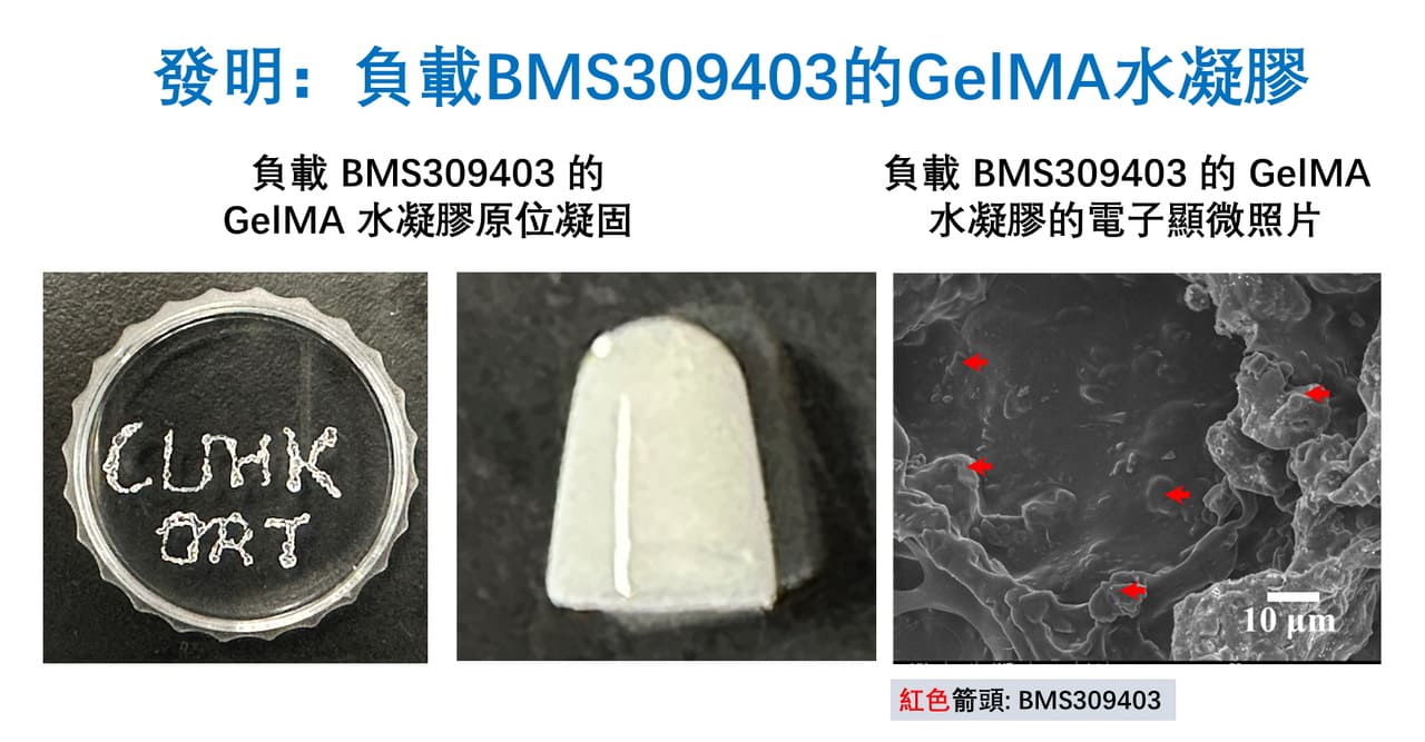 A Breakthrough Discovery in Tendinopathy Treatment: the World’s First Injectable Fatty Acidbinding Protein 4 Inhibitor-loaded Hydrogel
