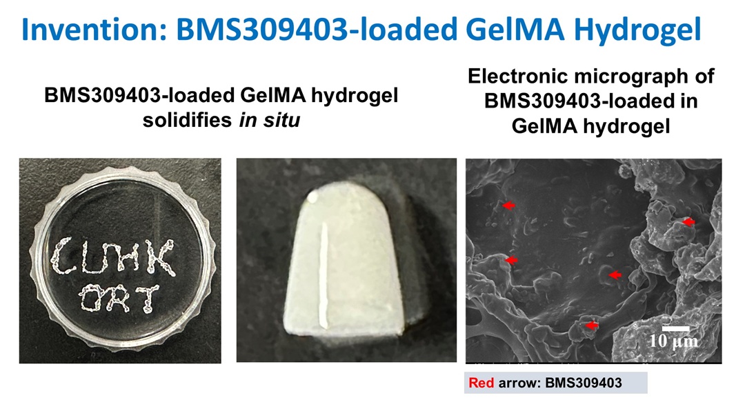 A Breakthrough Discovery in Tendinopathy Treatment: the World’s First Injectable Fatty Acidbinding Protein 4 Inhibitor-loaded Hydrogel
