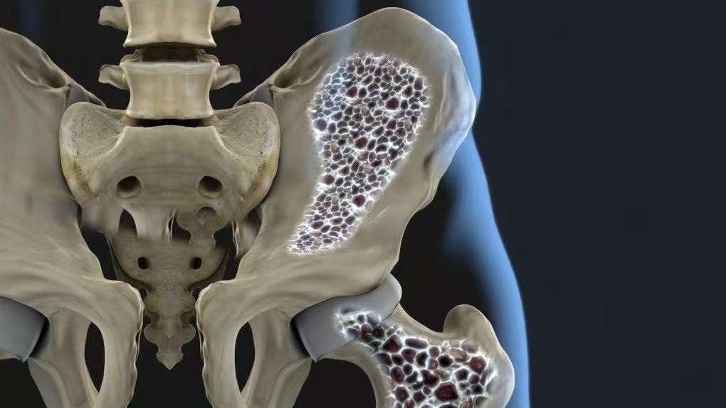 Development of novel anti-osteoporotic drug